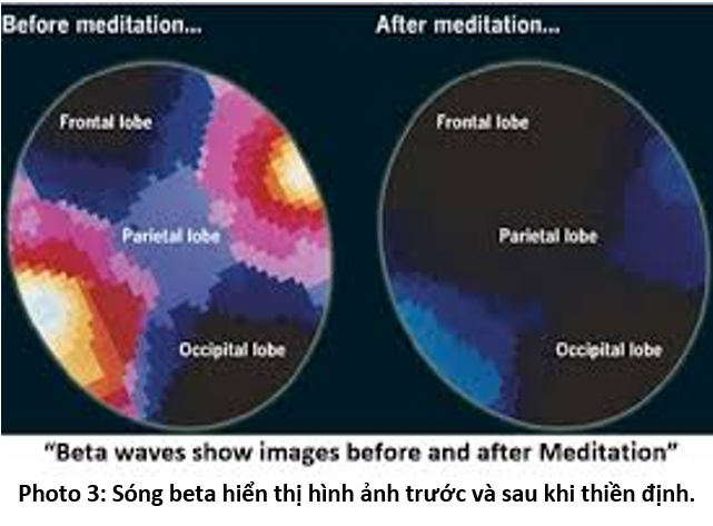 02. Thiền Định Sẽ Giúp 3