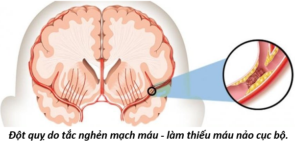 Vòng Tiểu Chu Thiên 6